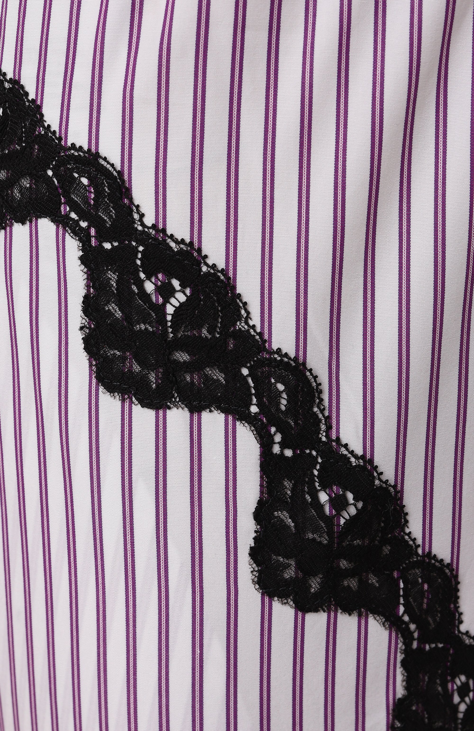 Хлопковые шорты THE ATTICO, арт. 250WCQ00002/CCC054AA, фото 6