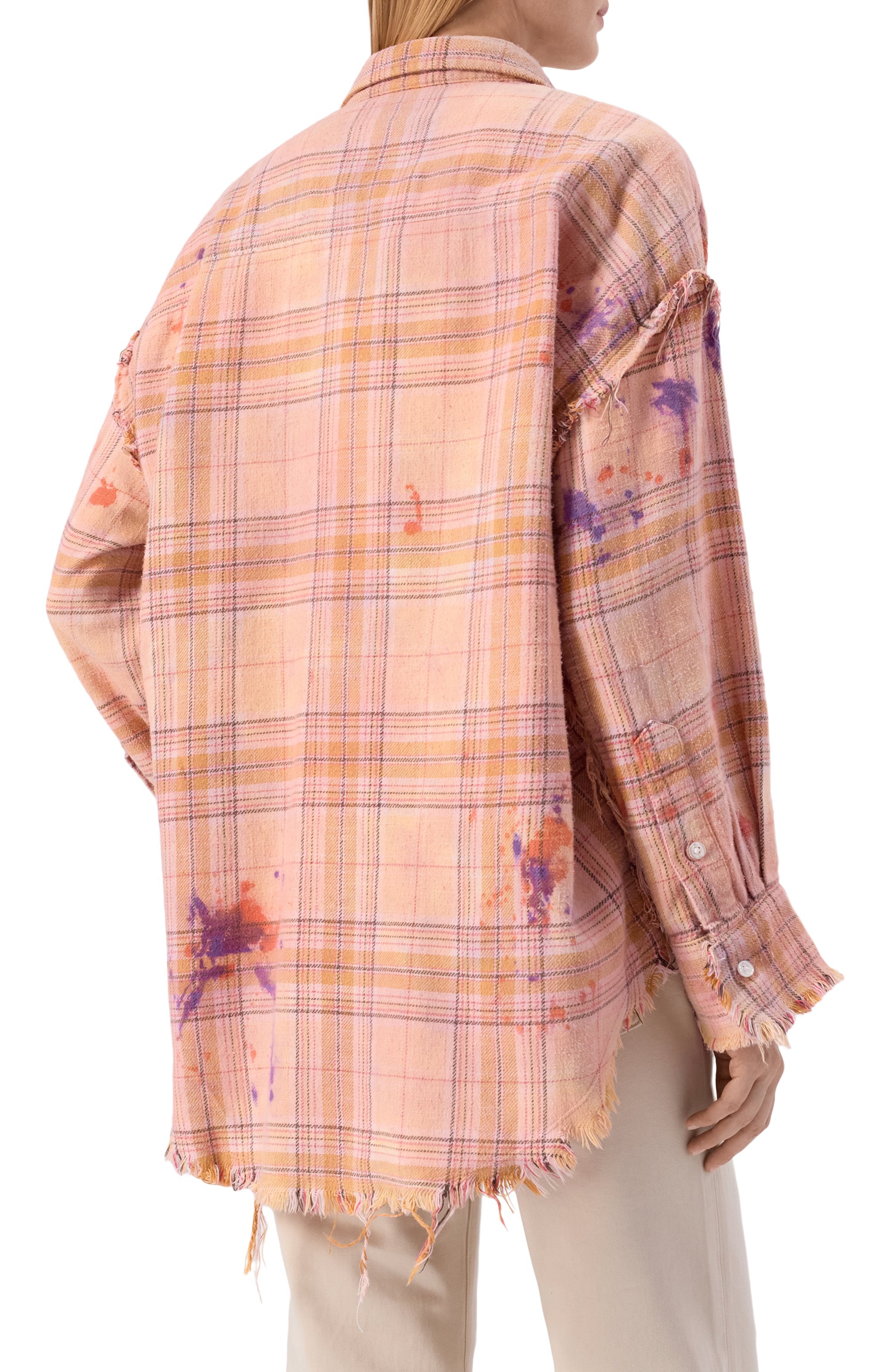 Хлопковая рубашка R13, арт. R13WR075-R654B_001, фото 4